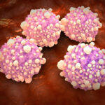 Daily Pill Doubles Survival Time for Pancreatic Cancer Patients, Researchers Report