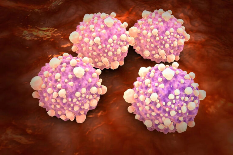 Daily Pill Doubles Survival Time for Pancreatic Cancer Patients, Researchers Report
